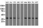 HIBCH Antibody in Western Blot (WB)