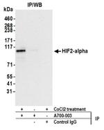 HIF2-alpha Antibody in Western Blot (WB)