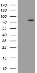 HIF3A Antibody in Western Blot (WB)