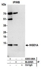 HIGD1A Antibody in Western Blot (WB)