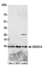 HIGD1A Antibody in Western Blot (WB)