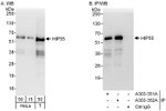 HIP55 Antibody in Western Blot (WB)