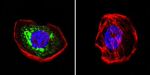 HIP Antibody in Immunocytochemistry (ICC/IF)