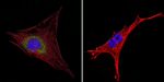 HIP Antibody in Immunocytochemistry (ICC/IF)