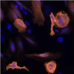 6x-His Tag Antibody in Immunocytochemistry (ICC/IF)