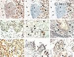 Glucocorticoid Receptor Antibody in Immunohistochemistry (Paraffin) (IHC (P))