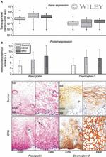 gamma Catenin Antibody in Immunohistochemistry (IHC)