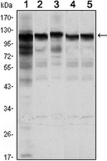 HK1 Antibody in Western Blot (WB)