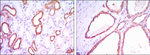 HK1 Antibody in Immunohistochemistry (Paraffin) (IHC (P))