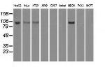 HK2 Antibody in Western Blot (WB)