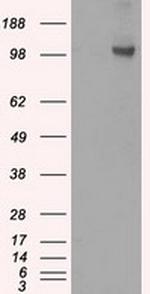 HK2 Antibody in Western Blot (WB)