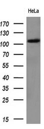 HK2 Antibody in Western Blot (WB)