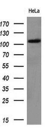 HK2 Antibody in Western Blot (WB)