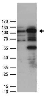 HLTF Antibody in Western Blot (WB)