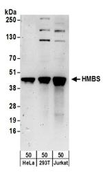 HMBS Antibody in Western Blot (WB)