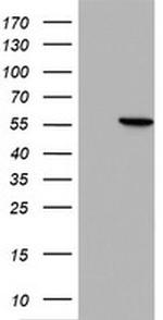 HMBS Antibody in Western Blot (WB)