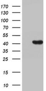 HMBS Antibody in Western Blot (WB)