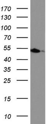 HMBS Antibody in Western Blot (WB)