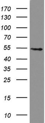 HMBS Antibody in Western Blot (WB)