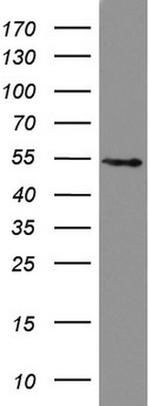 HMBS Antibody in Western Blot (WB)