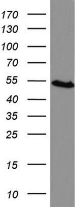 HMBS Antibody in Western Blot (WB)