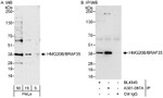 HMG20B/BRAF35 Antibody in Western Blot (WB)