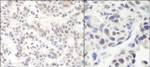 HMG2a Antibody in Immunohistochemistry (IHC)