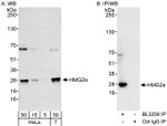 HMG2a Antibody in Western Blot (WB)