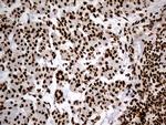 HNRNPH1 Antibody in Immunohistochemistry (Paraffin) (IHC (P))