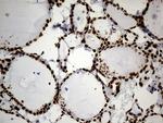 HNRNPH1 Antibody in Immunohistochemistry (Paraffin) (IHC (P))