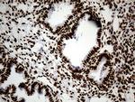 HNRNPH1 Antibody in Immunohistochemistry (Paraffin) (IHC (P))