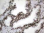 HNRNPH1 Antibody in Immunohistochemistry (Paraffin) (IHC (P))