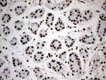 HNRNPH1 Antibody in Immunohistochemistry (Paraffin) (IHC (P))