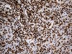 HNRNPH1 Antibody in Immunohistochemistry (Paraffin) (IHC (P))