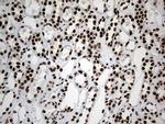 HNRNPH1 Antibody in Immunohistochemistry (Paraffin) (IHC (P))