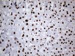 HNRNPH1 Antibody in Immunohistochemistry (Paraffin) (IHC (P))