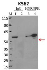 hnRNP K Antibody in Immunoprecipitation (IP)