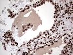 HNRNPL Antibody in Immunohistochemistry (Paraffin) (IHC (P))