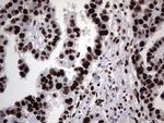 HNRNPL Antibody in Immunohistochemistry (Paraffin) (IHC (P))