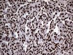 HNRNPL Antibody in Immunohistochemistry (Paraffin) (IHC (P))