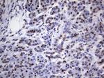 HNRNPL Antibody in Immunohistochemistry (Paraffin) (IHC (P))