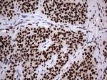 HNRNPL Antibody in Immunohistochemistry (Paraffin) (IHC (P))