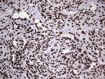 HNRNPL Antibody in Immunohistochemistry (Paraffin) (IHC (P))