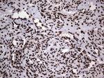 HNRNPL Antibody in Immunohistochemistry (Paraffin) (IHC (P))