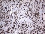 HNRNPL Antibody in Immunohistochemistry (Paraffin) (IHC (P))