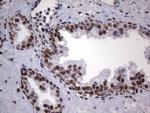 HNRNPL Antibody in Immunohistochemistry (Paraffin) (IHC (P))