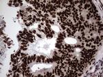 HNRNPL Antibody in Immunohistochemistry (Paraffin) (IHC (P))