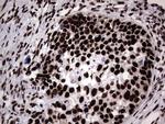 HNRNPL Antibody in Immunohistochemistry (Paraffin) (IHC (P))