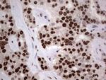 HNRNPL Antibody in Immunohistochemistry (Paraffin) (IHC (P))