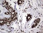 HNRNPL Antibody in Immunohistochemistry (Paraffin) (IHC (P))